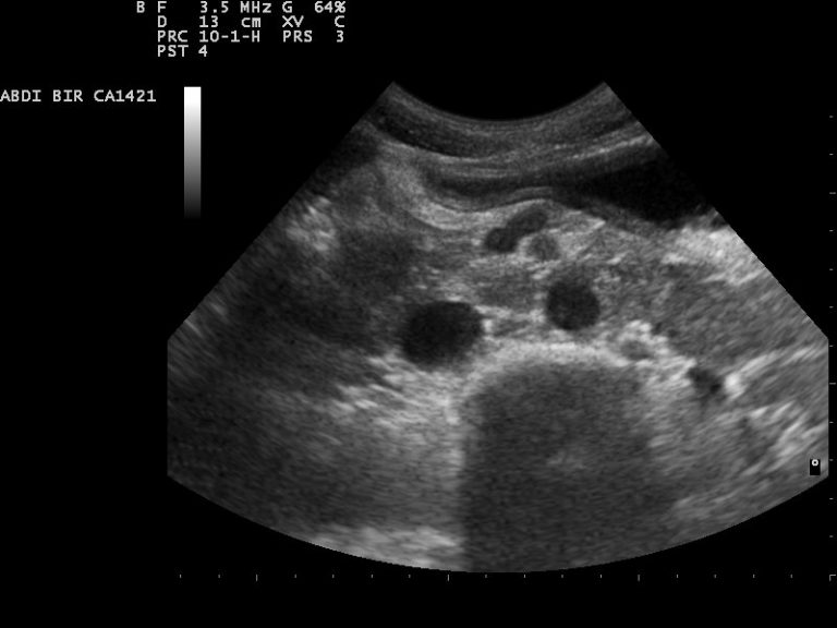 how-much-does-a-4d-ultrasound-cost-in-2022