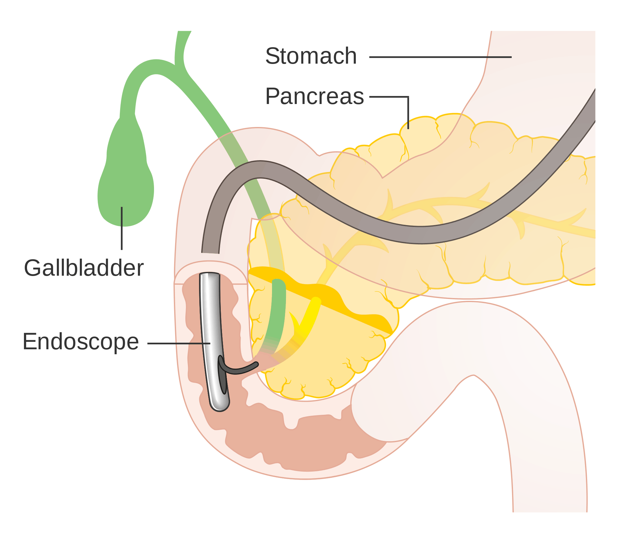 How Much Does Endoscopy Cost In 2022?