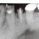 xray dental formation price