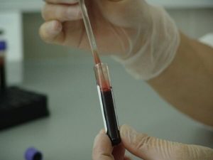 Average Pap Smear Test Price